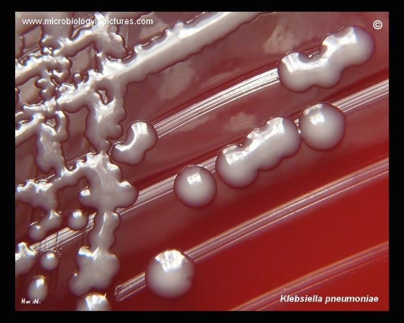 K.pneumoniae colonies